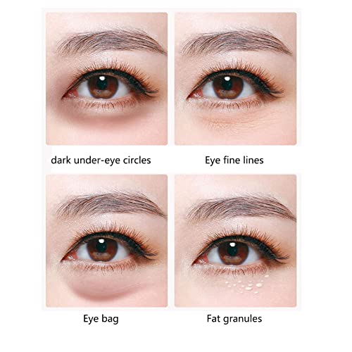 10 יחידות מסיכת עיניים טיפוח עיניים עור עיגול כהה עיסוי עיניים מזדקן מבטל עיניים נפוחות קו עדין קמטים