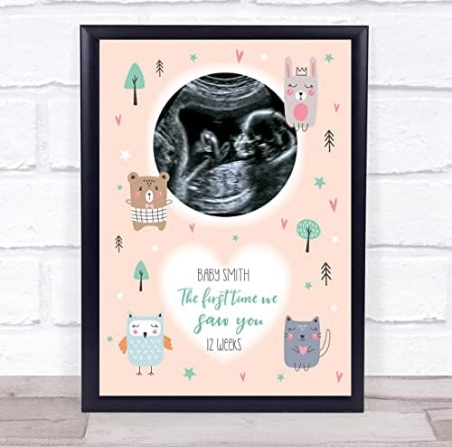 תינוק הריון סריקת תמונה תמונה אפרסק חיות מזכרת מתנת הדפסה